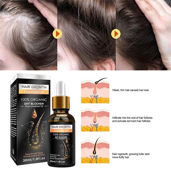 Hair Growth Essential Oil 100 % organic Biotin Cold-Pressed DHT Blocker