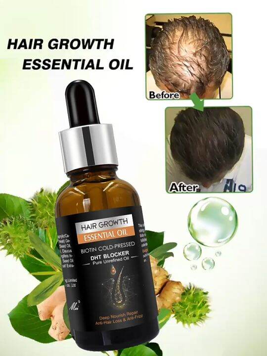 Hair Growth Essential Oil 100 % organic Biotin Cold-Pressed DHT Blocker