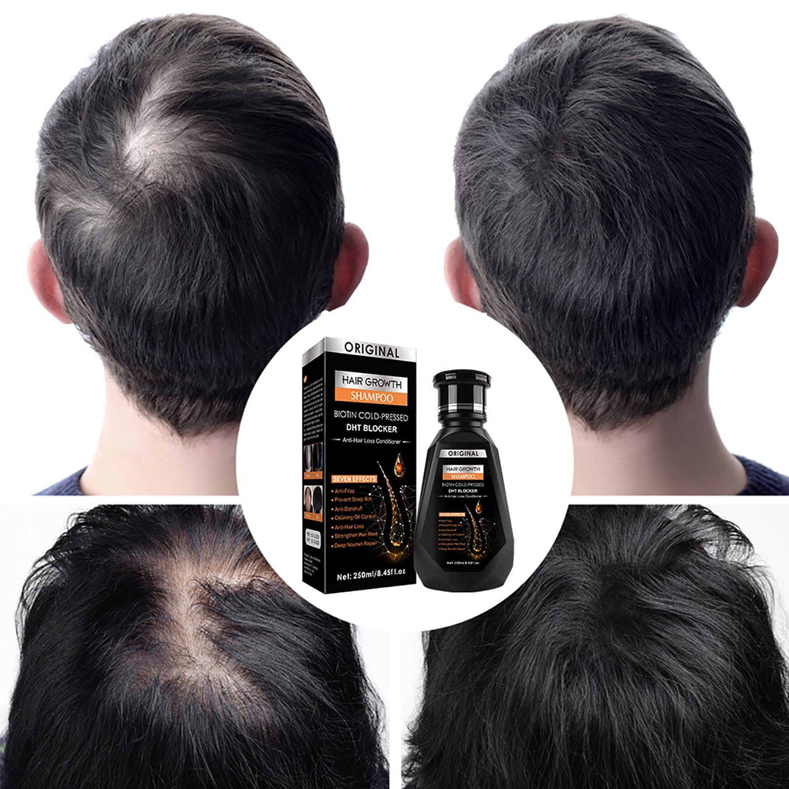 BIOTIN Cold Pressed Original Anti Hair Loss Hair Growth Shampoo